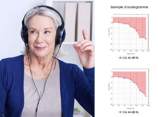 ¿Cómo se desarrolla una revisión auditiva?